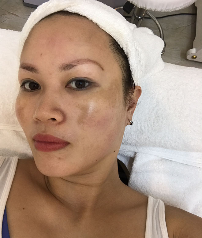 "Tủ lạnh 3 con" Hà thành phẫu thuật từ đầu tới chân để đẹp như thời 20 - 6