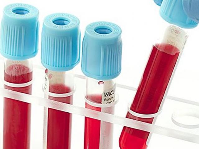 Sốc với kết quả xét nghiệm hoá chất độc hại trong máu của người Hà Nội