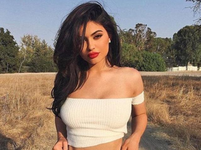 Môi suýt "nổ tung" vì đi bơm cho giống thần tượng