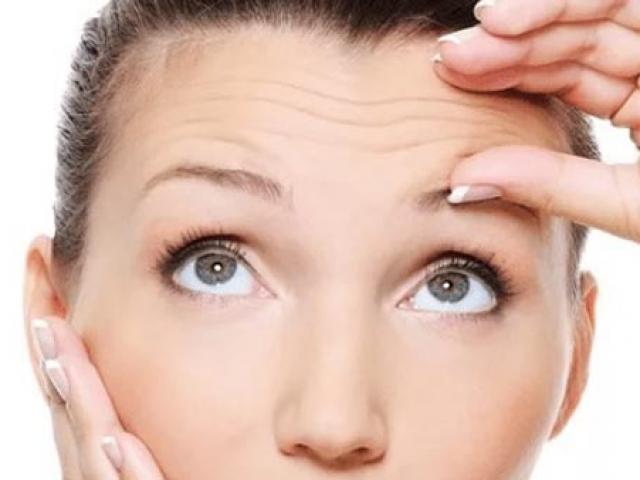 Dễ chết vì đau tim do trán sớm có nếp nhăn!