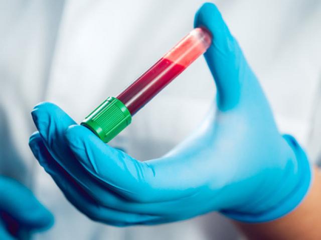 Người đầu tiên trên thế giới nhiễm viêm gan siêu vi E lạ lùng