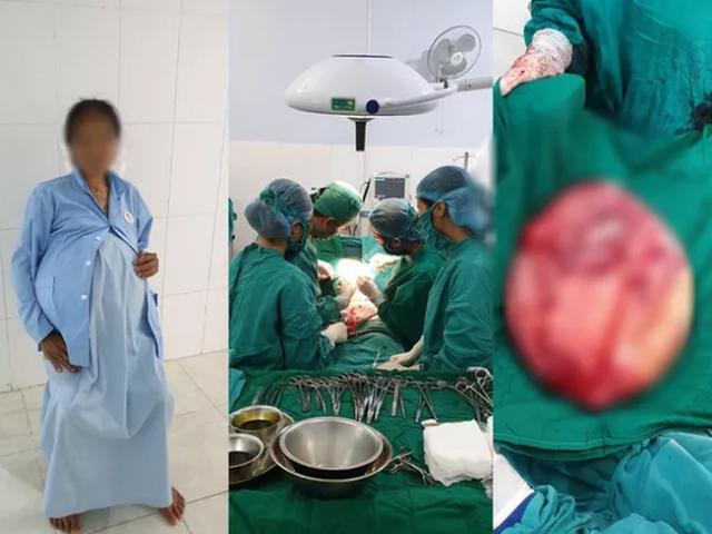 Cô giáo mầm non đeo "bụng bầu" nặng 25 kg suốt 14 năm Cô giáo mầm non đeo "bụng bầu" nặng 25 kg suốt 14 năm