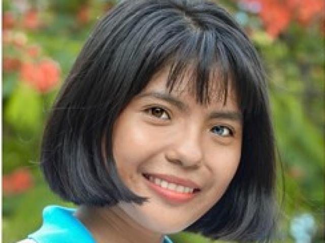 Cô gái Việt Nam xinh đẹp có đôi mắt hai màu: Căn bệnh hiếm gặp trên thế giới Cô gái Việt Nam xinh đẹp có đôi mắt hai màu: Căn bệnh hiếm gặp trên thế giới