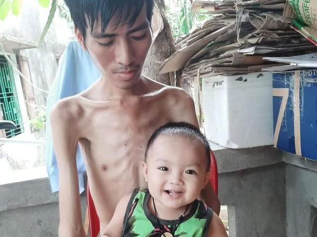 Đau xót cảnh người cha cố duy trì sự sống để chờ hiến thận cho con