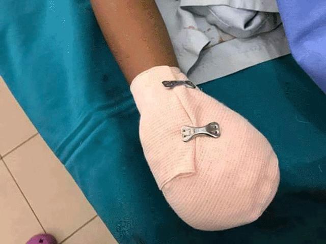 Mất mạng, nát tay và những hậu quả khủng khiếp khi vừa dùng điện thoại vừa sạc Mất mạng, nát tay và những hậu quả khủng khiếp khi vừa dùng điện thoại vừa sạc