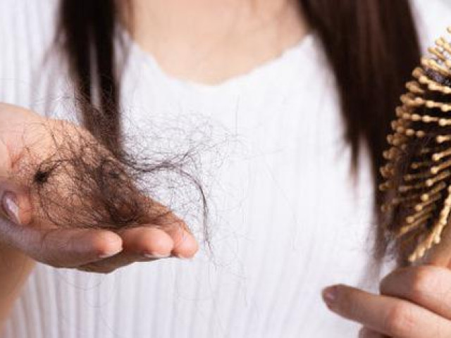 Chị em đừng dại mà động vào các loại thực phẩm này nhiều nếu không chẳng mấy chốc mà hói đầu Chị em đừng dại mà động vào các loại thực phẩm này nhiều nếu không chẳng mấy chốc mà hói đầu