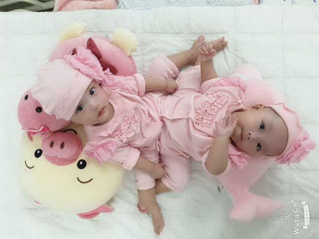 Bác sĩ trực tiếp tách cặp Song Nhi: “Cảm xúc như thuở ban đầu“ Bác sĩ trực tiếp tách cặp Song Nhi: “Cảm xúc như thuở ban đầu“