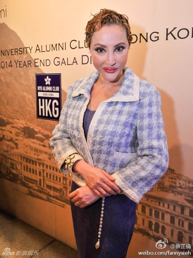 8 năm làm "thảm họa mặt rắn" của mỹ nhân dao kéo Hồng Kông - 6