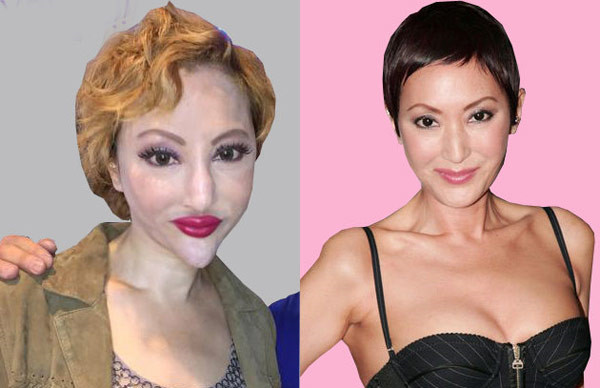 8 năm làm "thảm họa mặt rắn" của mỹ nhân dao kéo Hồng Kông - 5