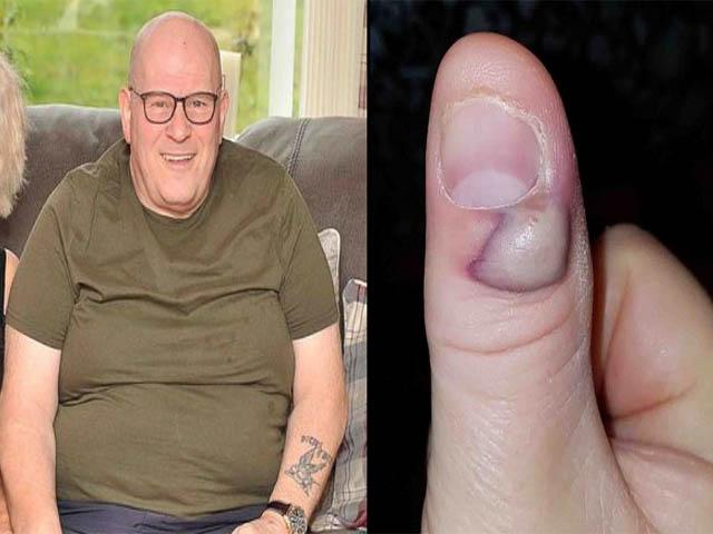 Thói quen tưởng hoàn toàn vô hại khiến người đàn ông suýt nhận án tử