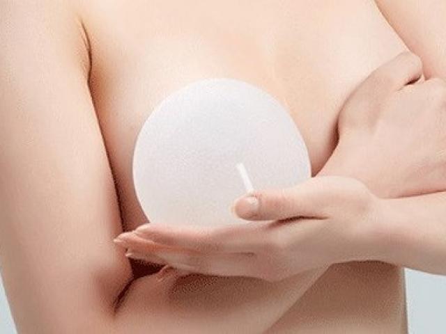 Nổ ngực vì đi máy bay sau khi bơm độn túi silicon: Chuyên gia nói gì?