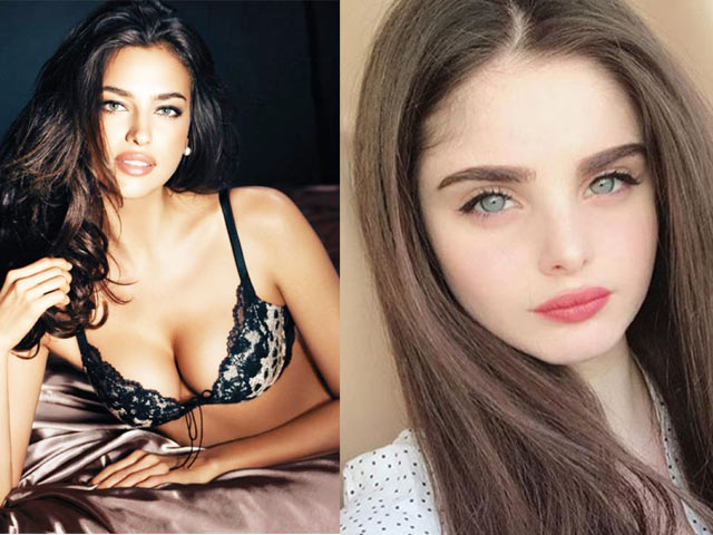 Đôi môi &#34;thái vội được 2 đĩa&#34; của Irina Shayk là chuẩn mới của gái đẹp Nga