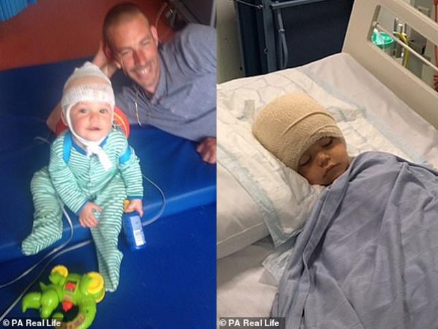 Bé con cười không ngừng suốt 17 tiếng, tưởng là chuyện tốt không ngờ bệnh cực hiếm