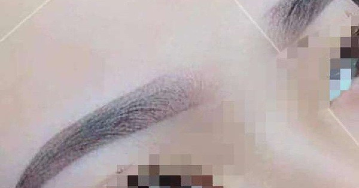 Người phụ nữ hôn mê sau xăm chân mày ở TP.HCM đã tử vong