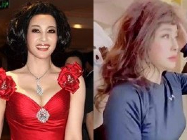 Nghi vấn gương mặt của “Quốc bảo“ Lưu Hiểu Khánh biến dạng vì thẩm mỹ